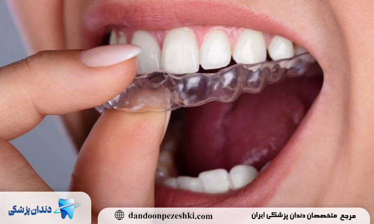 روش نوین در ارتودنسی سریع