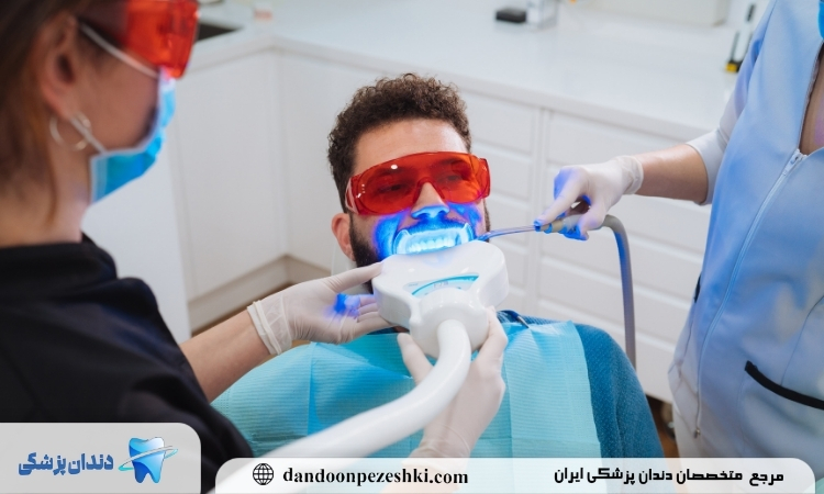 انواع بلیچینگ دندان