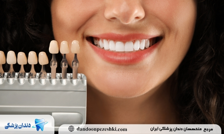 کامپوزیت دندان