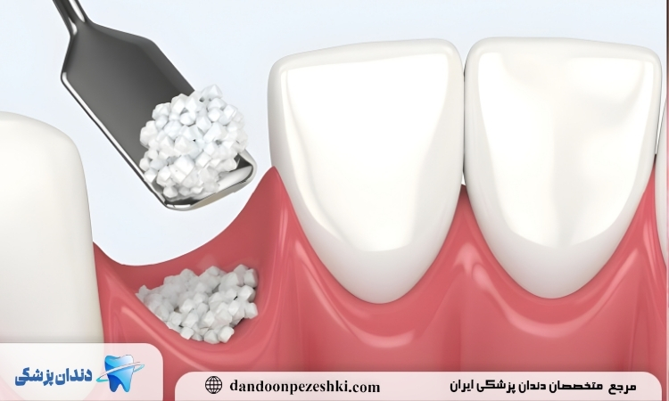 پودر استخوان