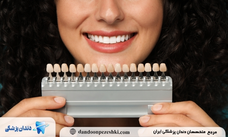 اهمیت کامپوزیت دندان