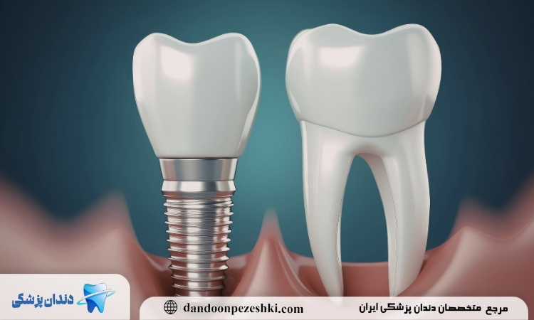 دندان آسیب دیده