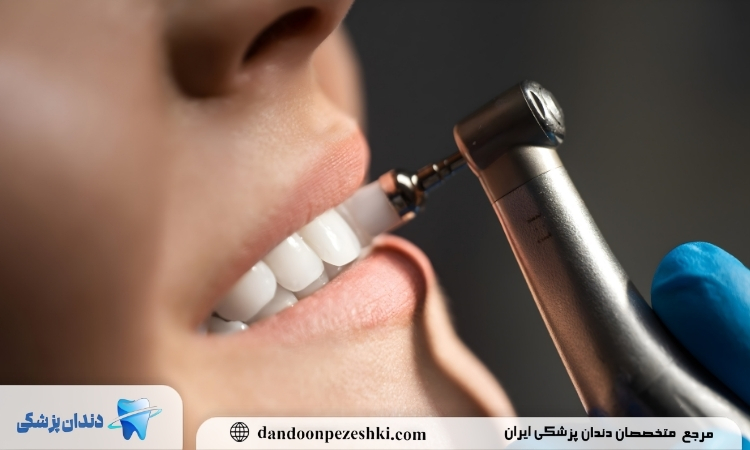 بررسی فواید و مزایای جرم گیری دندان