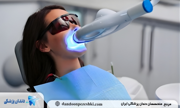 بلیچینگ دندان