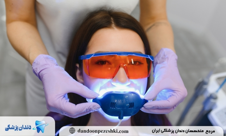 سفیدی دندان