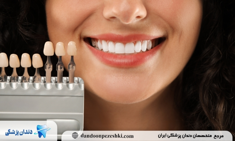 زیبایی دندان