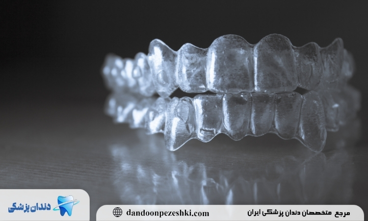 زمان قالب گیری دندان