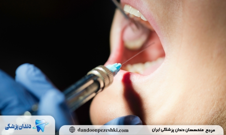 بی حسی متفاوت موضعی