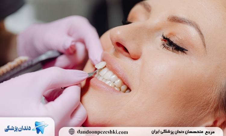 ترمیم دندان جلو
