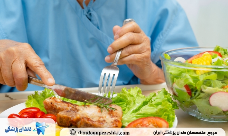 کاشت ایمپلنت