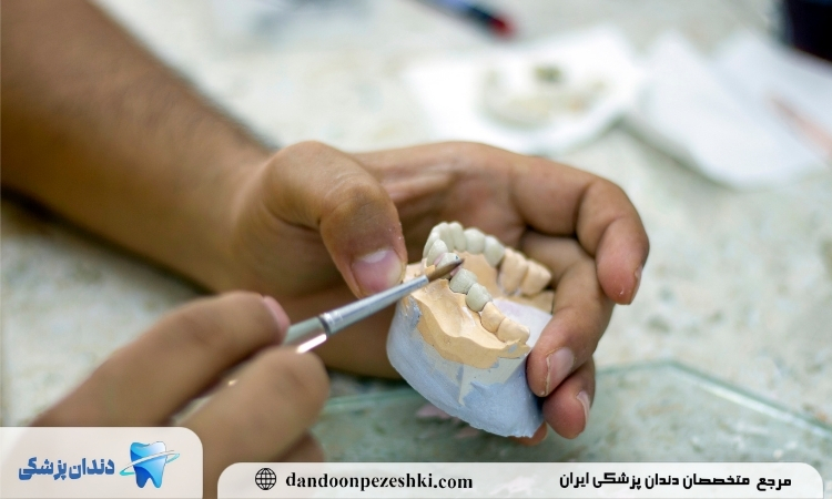 زمان پروتز دندان