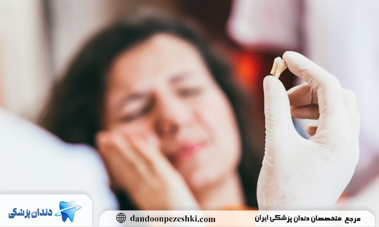 بوی بد دهان