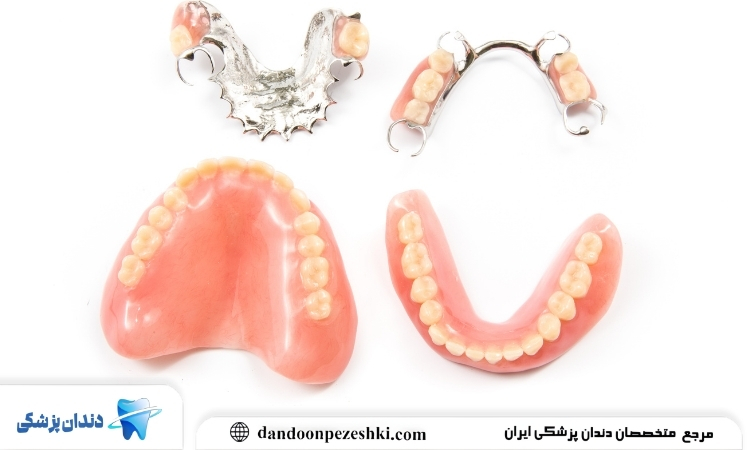 دندان مصنوعی ثابت بهتر است یا متحرک؟