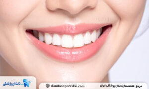 راز سفیدی دندان بازیگران