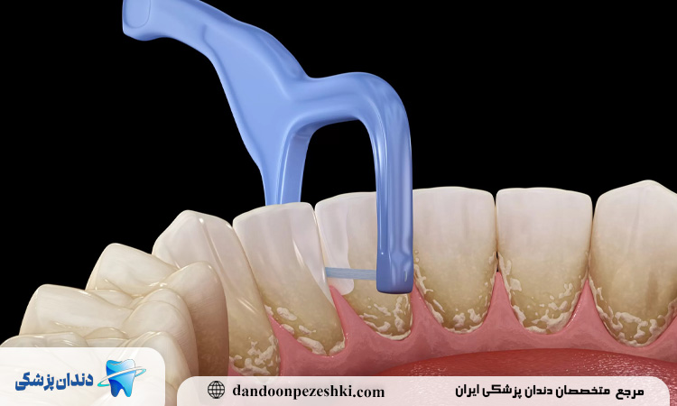 حفظ سلامت دندان