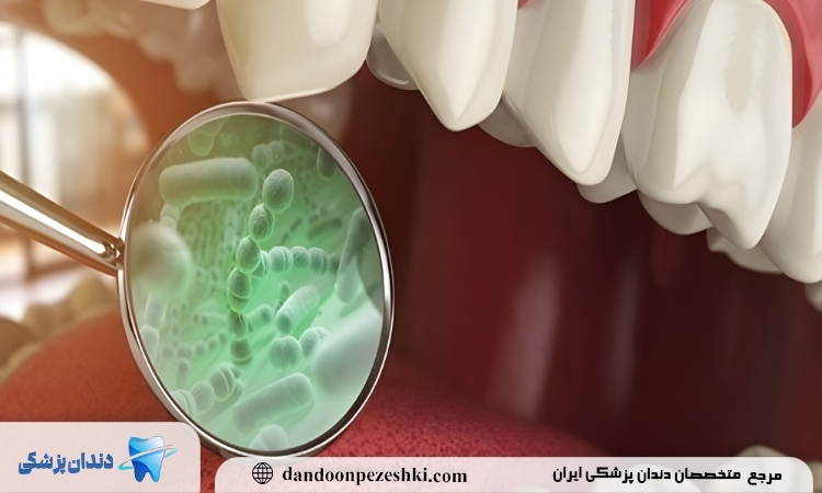 روش های جلوگیری از عفونت ایمپلنت