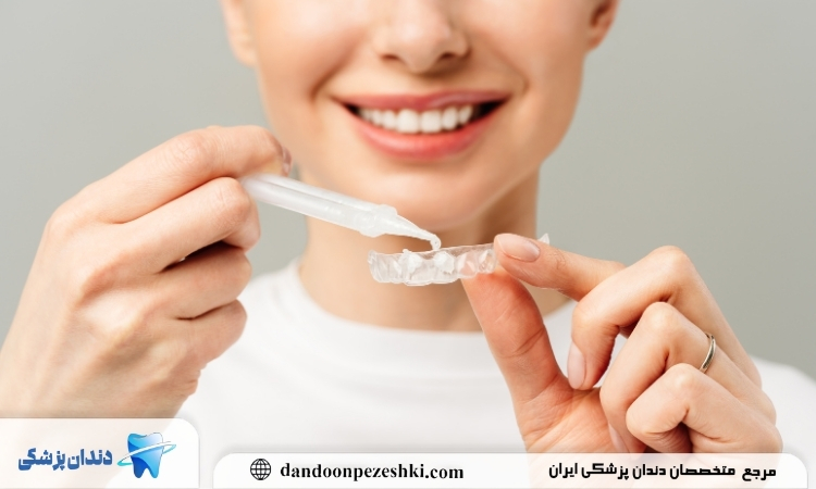 سفید کردن دندان در خانه