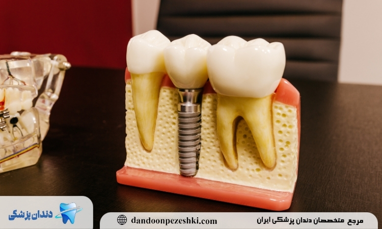 عوارض عدم رعایت رژیم غذایی