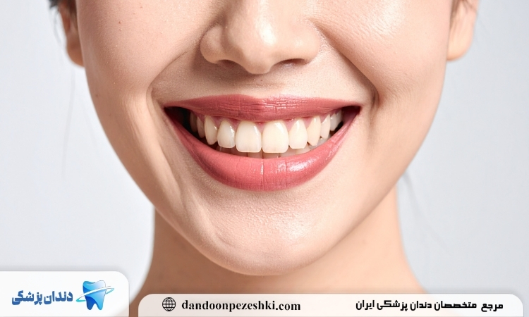 بریچ دندان چیست؟