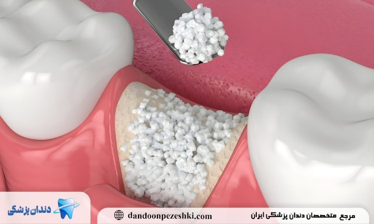 مصرف پودر استخوان