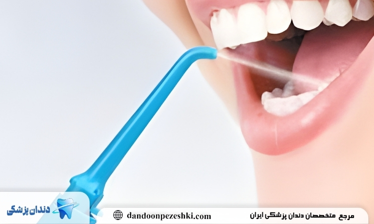 مزایای واترجت یا واترپیک دندان