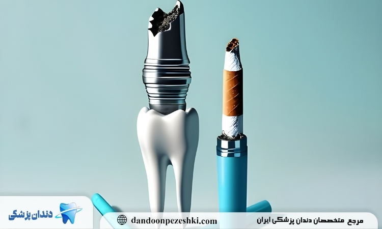مصرف سیگار پس از ایمپلنت دندان
