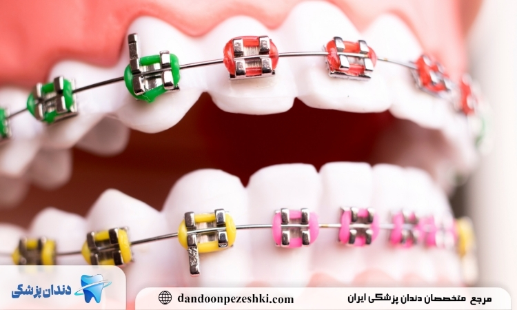 ارتودنسی دندان