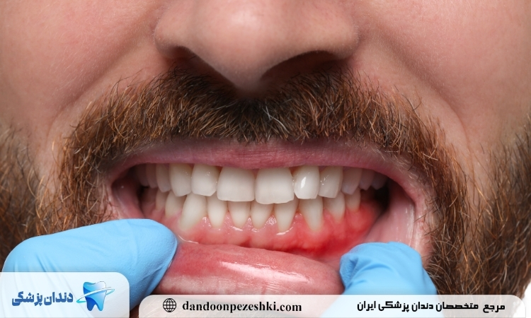 سلامت دندان