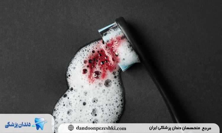 نکته ی قطع خونریزی دندان