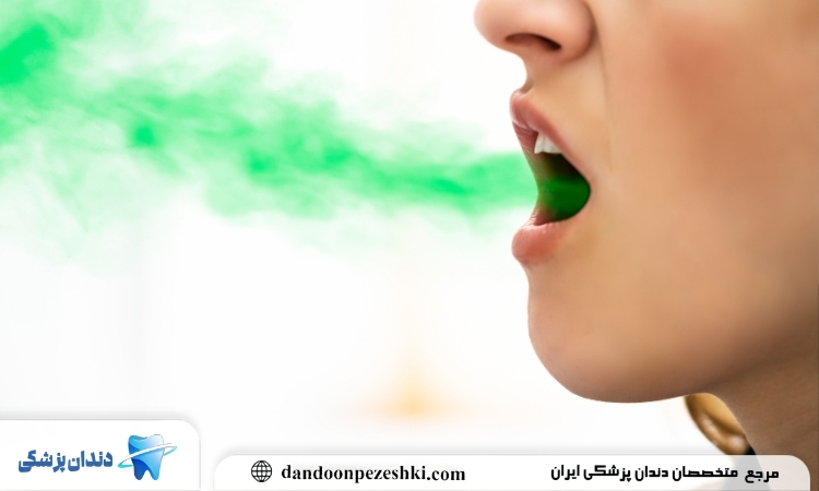 همه چیز درباره بوی بد دهان