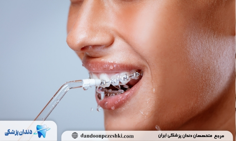 پاکسازی دندان