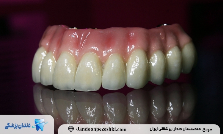 معایب پروتز دندان