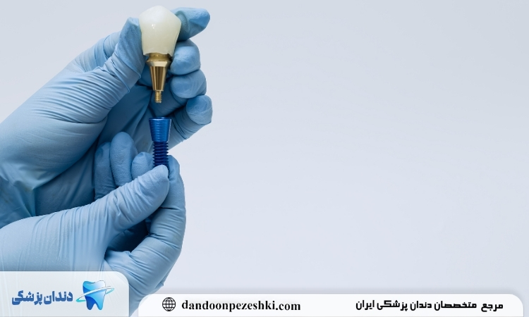 جراحی ایمپلنت