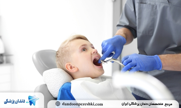 جایگزینی دندان کشیده شده کودک