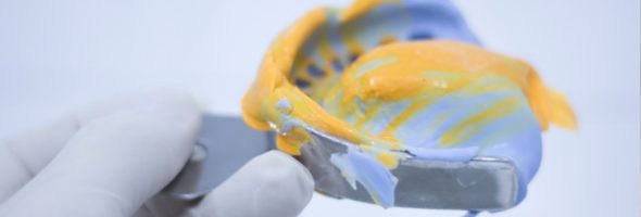 بهترین زمان قالبگیری دندان