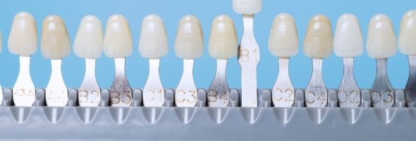 رنگ بندی کامپوزیت دندان