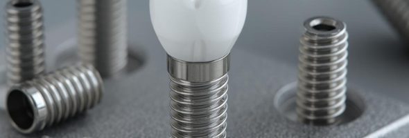 مقایسه ایمپلنت سوئیسی با آلمانی